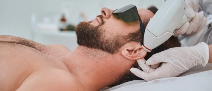 بهترین لیزر برای موهای زائد